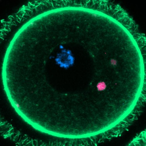 Las estructuras especiales halladas en un ovocito de ratón.  Imagen: Gabriele Zaffagnini/Centro de Regulación Genómica.